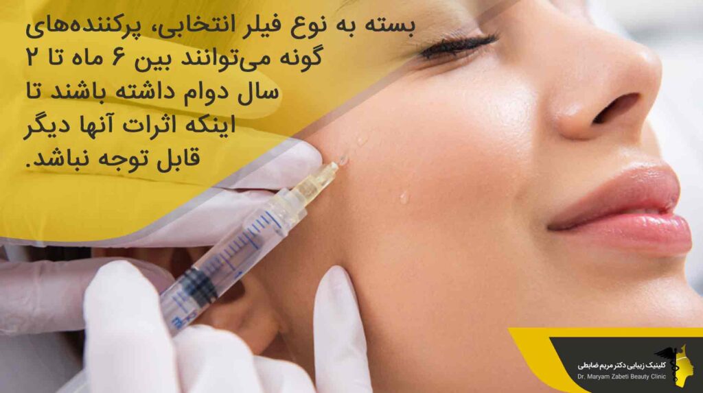 ماندگاری تزریق ژل گونه
