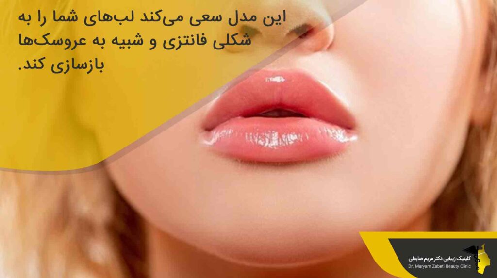 مدل عروسکی (باربی) یکی از انواع مدل های تزریق ژل لب