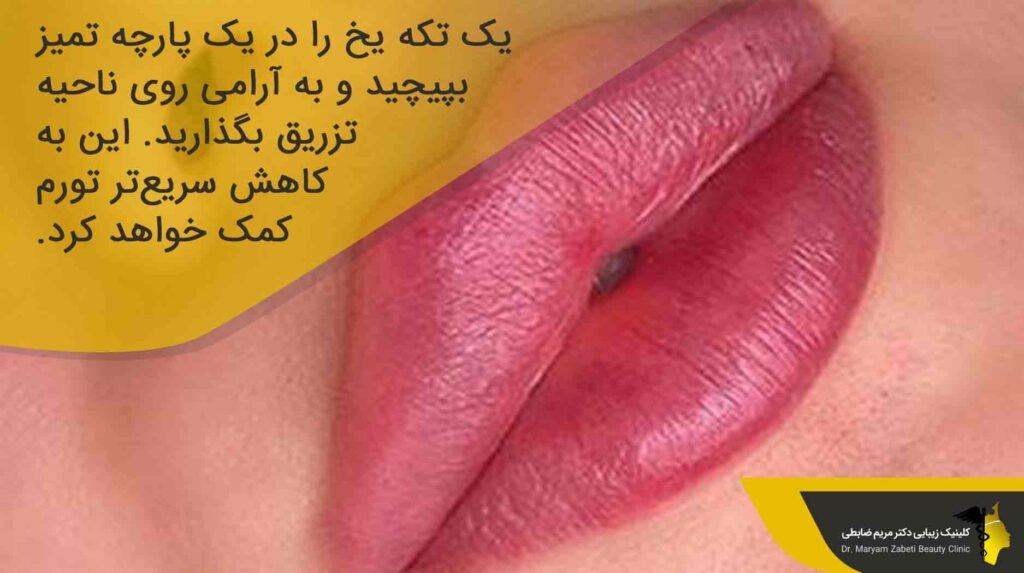 مراقبت های بعد از تزریق ژل لب