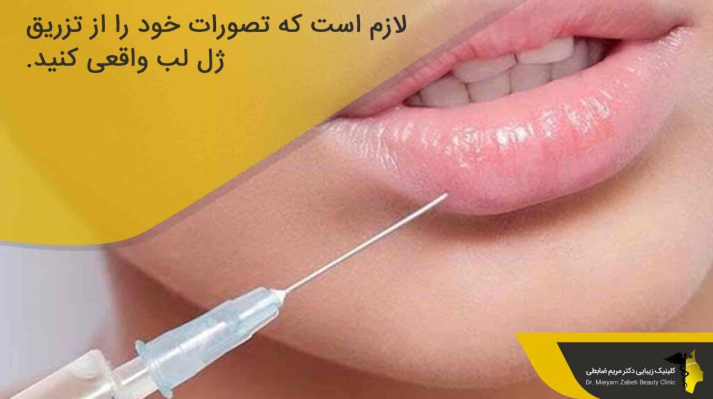 تصورات خود را از تزریق ژل لب واقعی کنید.