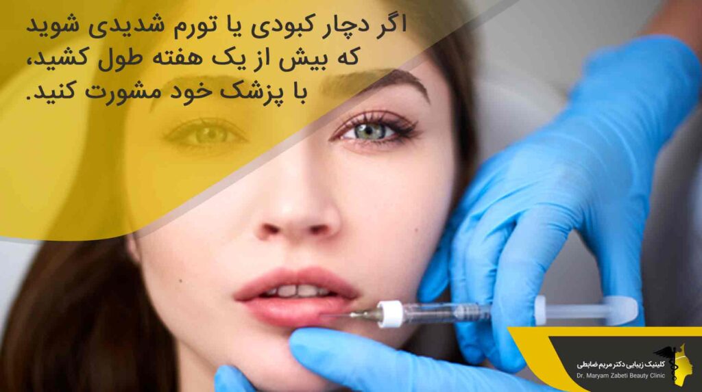کبودی یا تورم شدید بعد از تزریق ژل لب