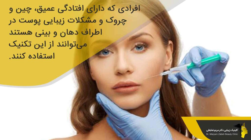 چه کسانی باید تزریق ژل خط لبخند را انجام دهند؟