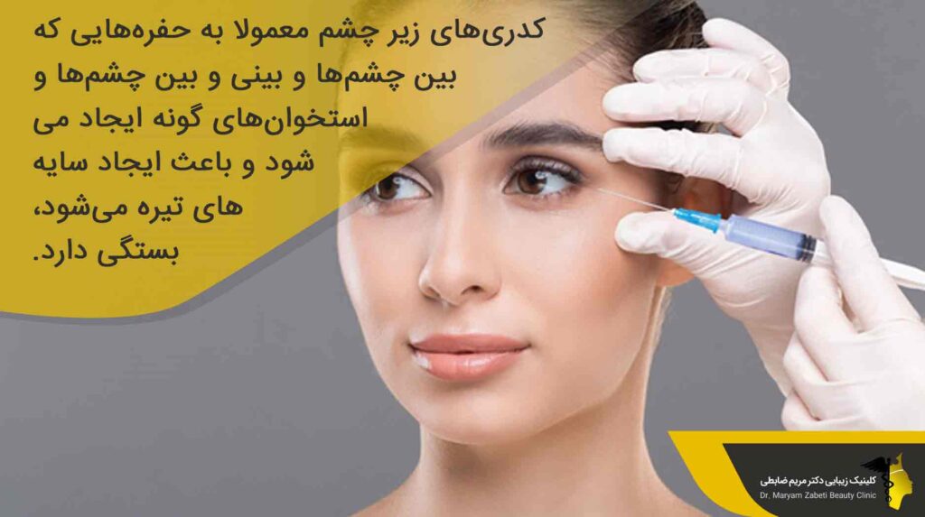 ژل در کدام قسمت‌های چشم تزریق می شود؟