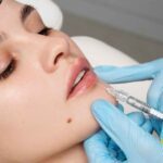 تزریق ژل لب طبیعی